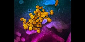 新型コロナウイルス「エアロゾルで最大3時間」感染力維持 プラスチック・ダンボールなら？