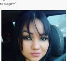 歯科医による違法な美容整形手術により鼻が黒く壊死してしまった女性(ブラジル)